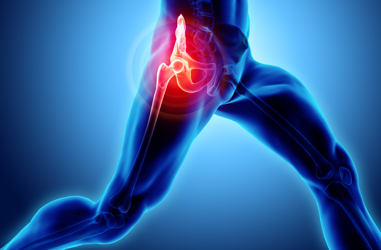 Can Back Problems Cause Hip And Knee Pain